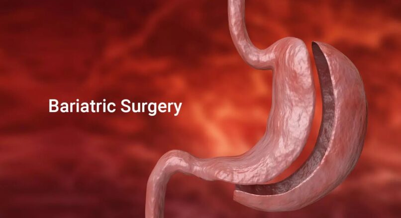 Benefits of Metabolic and Bariatric Surgery in Isb