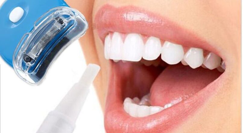 Best Time of Year for Laser Teeth Whitening Treatments