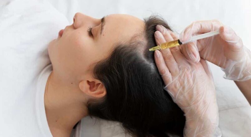 “PRP Hair Treatment: What Happens During the Consultation?”