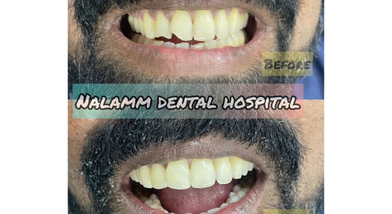 Dental Clinics In Kumbakonam-Nalamm Dental Clinics