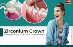 What is the cost of Zirconia crown in India? 3M Zirconia crown