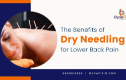 Exploring the Benefits of Dry Needling for Lower Back Pain